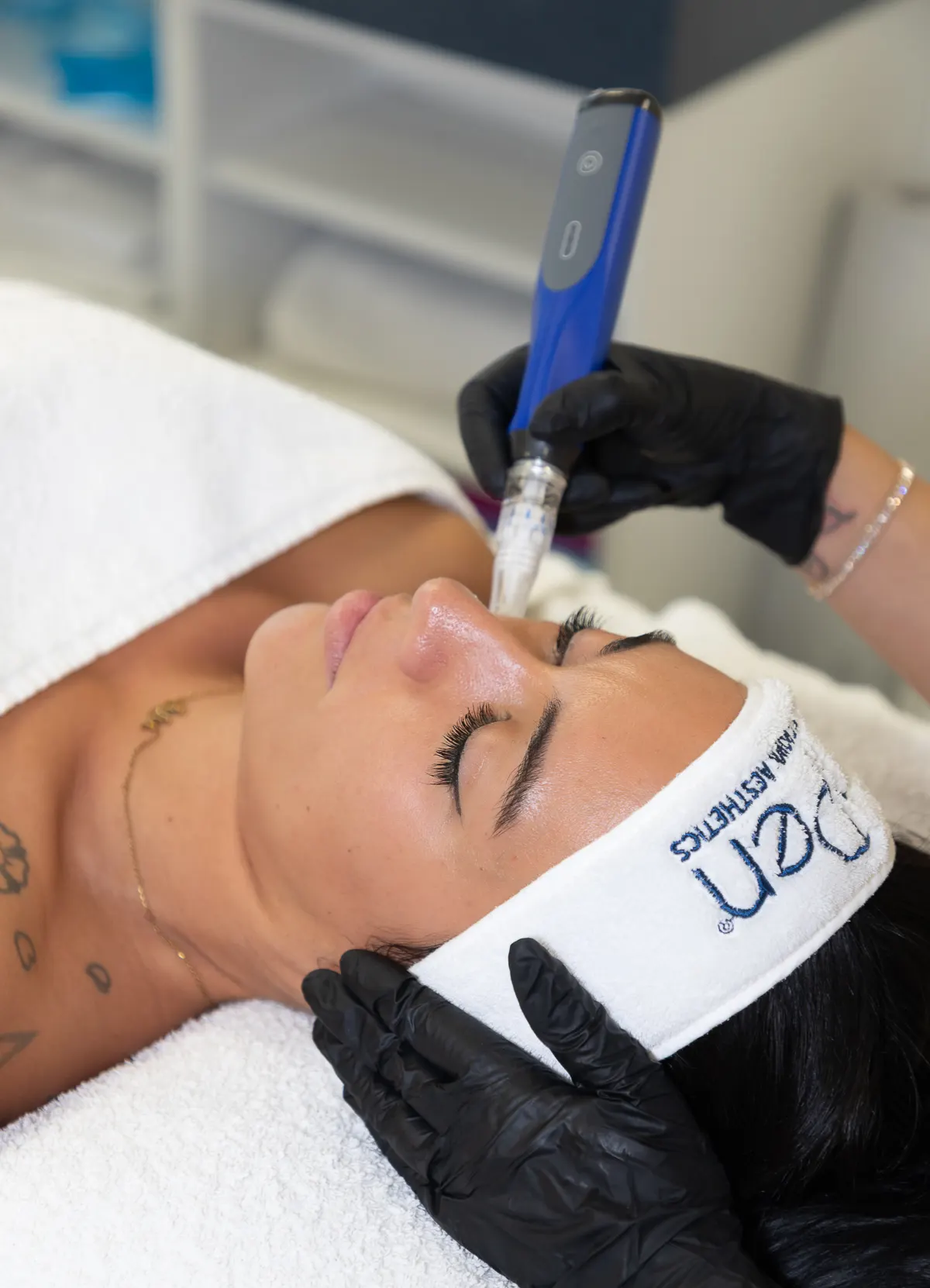 aplicación de skinpen en cara de mujer para Rejuvenecimiento Facial